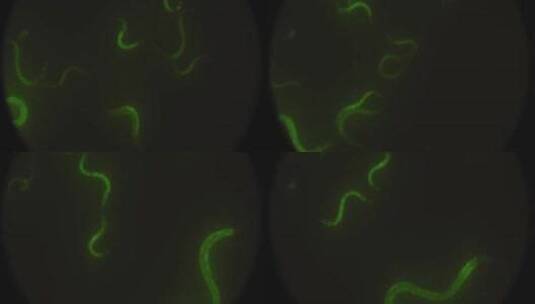 从显微镜上看到的在培养皿周围移动的微生物高清在线视频素材下载