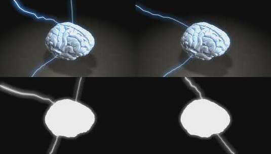 发出闪电光芒的大脑3D动画高清在线视频素材下载