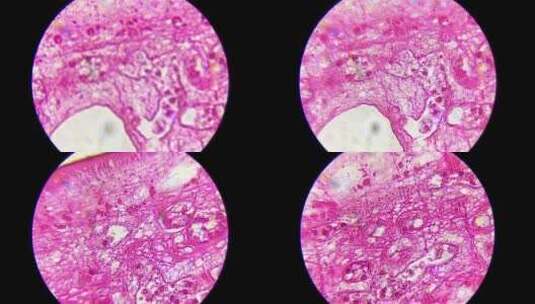 显微镜观察肝吸虫高清在线视频素材下载