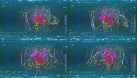 人体心脏病心梗血管动画扫描  4K高清在线视频素材下载
