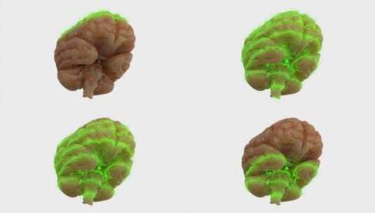 大脑、扫描、激光、科学高清在线视频素材下载