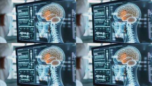 医生查看电脑中大脑医学图像高清在线视频素材下载